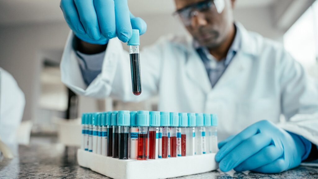 Blood Test Detects Faster Biological Aging, Raises Dementia Risk