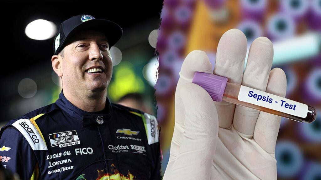 Kyle Busch Death Highlights How Pneumonia Triggers Rapid Sepsis