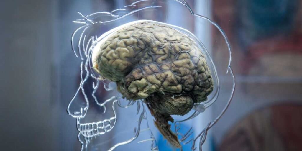 Bexorg Revives Donor Brains, Sparks Global Ethics Debate