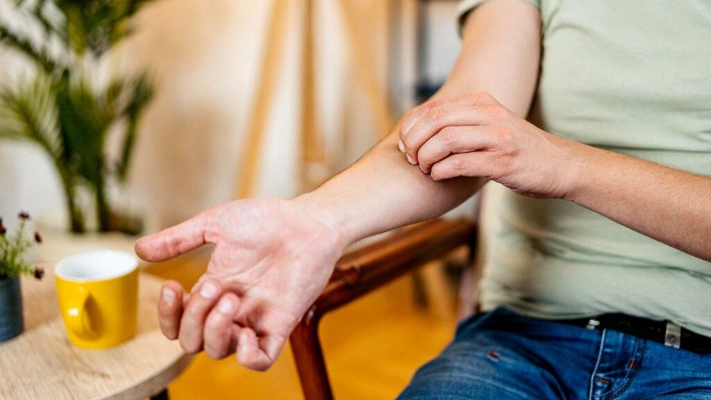 Scratching Worsens Eczema Inflammation, Mouse Study Shows
