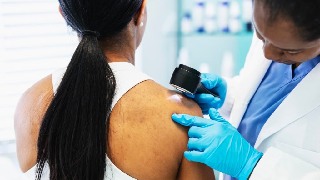 Melanoma Vaccine Cuts Return Risk In Landmark Trial