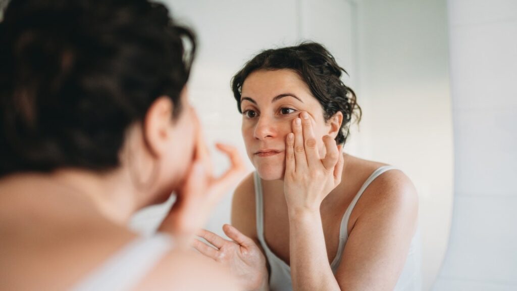 Doctors Warn Dark Under-Eye Circles May Signal Low Iron