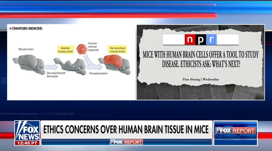 Stanford researchers face ethics concerns over transplanting human brain tissue to mice