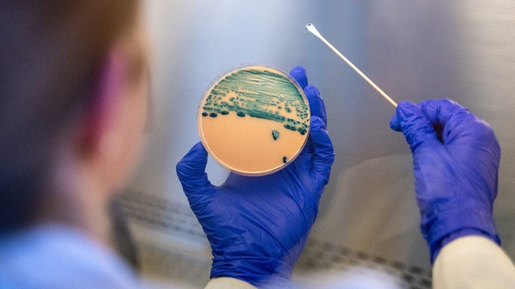 CDC Warns Shigella Resistance Surges, Standard Treatments Fail