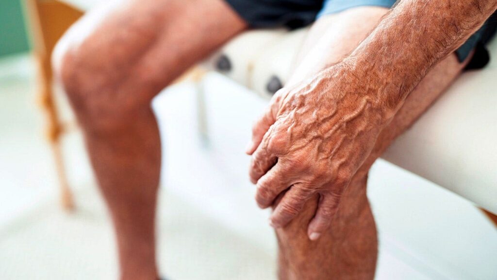 Non-Surgical Knee Treatment Eases Arthritis Pain For A Year
